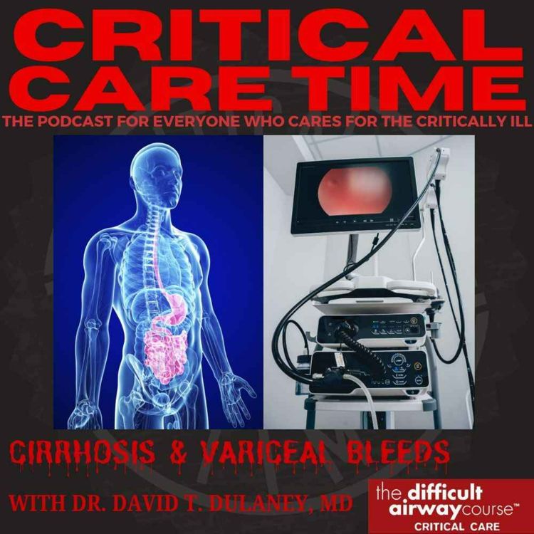 cover art for 55. Cirrhosis & Variceal Bleeds