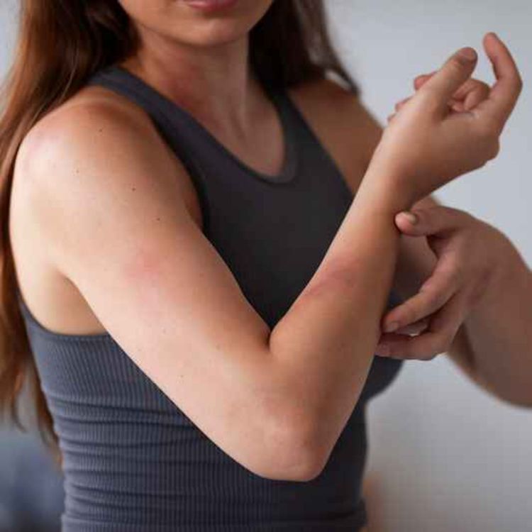 cover art for Vivre avec de l'eczéma