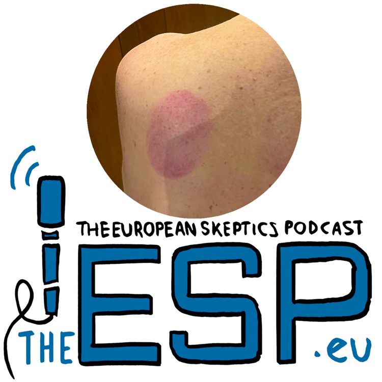 cover art for TheESP – Ep. #528 – Cupping Time!