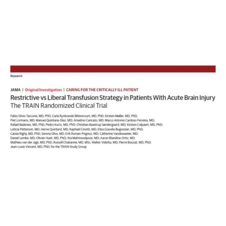 cover art for L'étude TRAIN