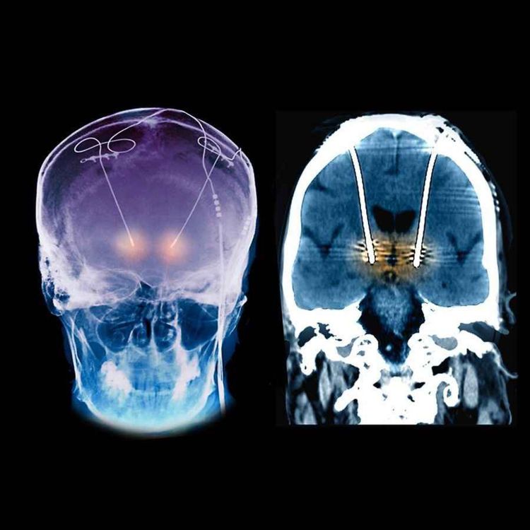 cover art for 050 - Whack Mirror