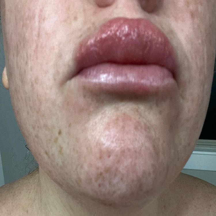 cover art for What The Hell Happened To Cassie's Face?!