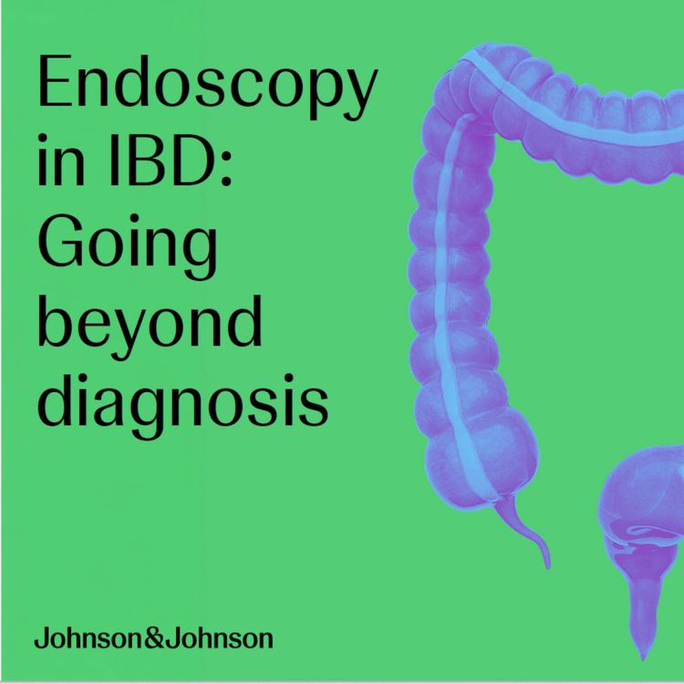 cover art for Endoscopy in IBD: Going beyond diagnosis
