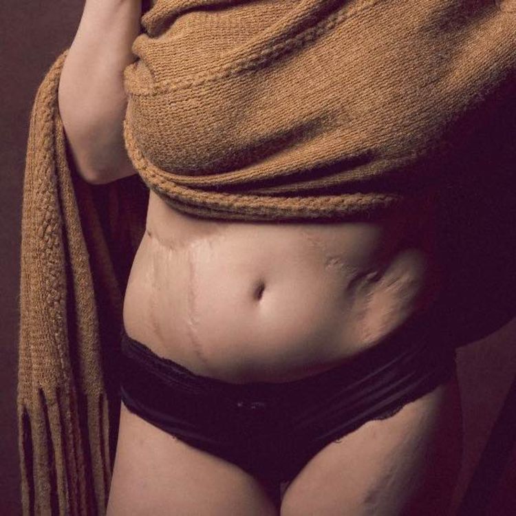 cover art for " De la souffrance à l'engagement "