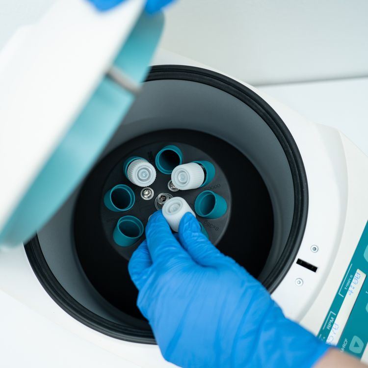 cover art for Preserving Dreams for Young Cancer Patients through Oncofertility 