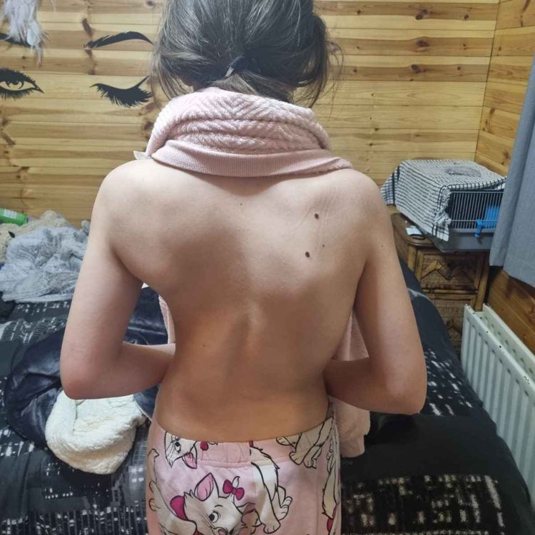 cover art for Ardee Man Speaks Out About his Disgust Over how Scoliosis Cases in Children are being Treated in Ireland - 15/08/2025