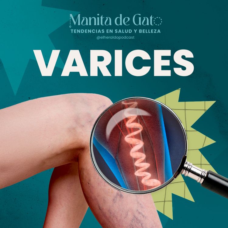 cover art for Várices y trombosis: cómo prevenir y cuidar la salud de tus piernas