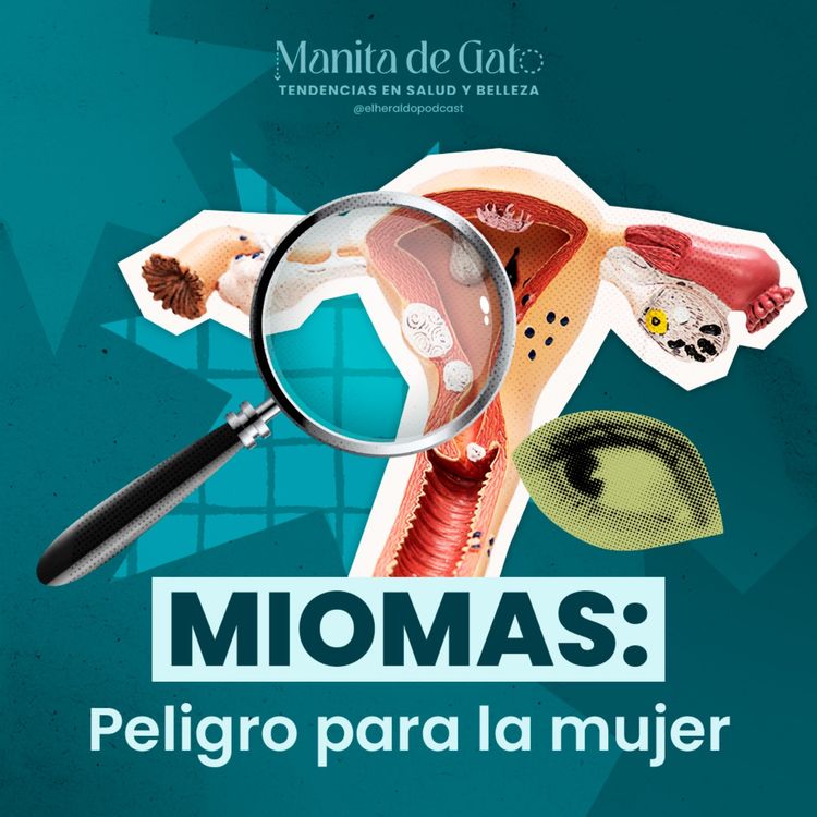 cover art for Miomatosis Uterina: Lo que Toda Mujer Debe Saber