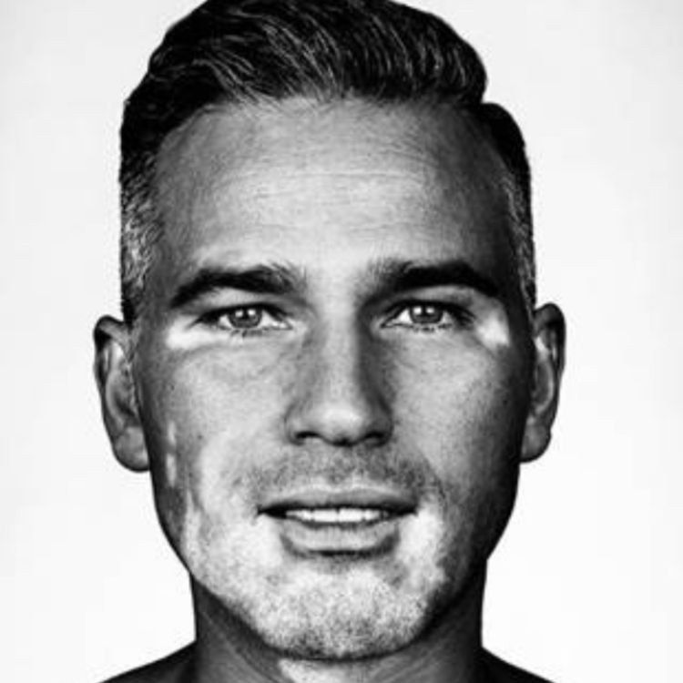 cover art for Dean Edwards: Growing Up With A Physical Difference Was Tough