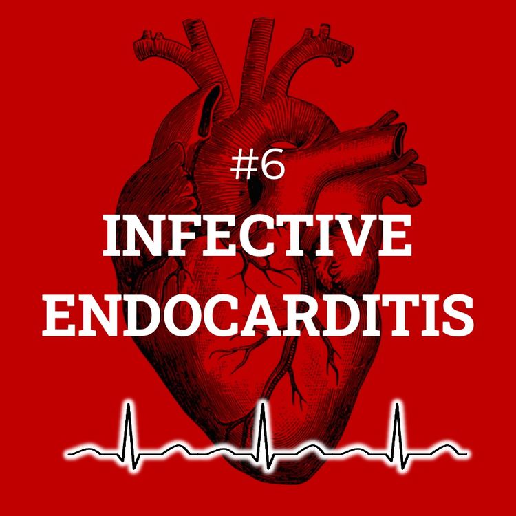 cover art for #6 Infective endocarditis