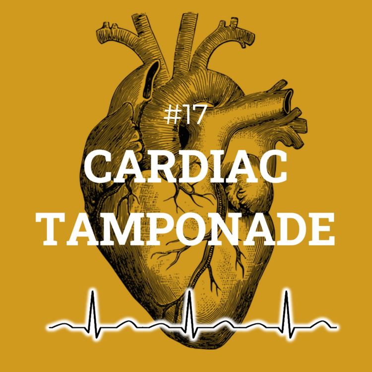 cover art for #17 Cardiac tamponade