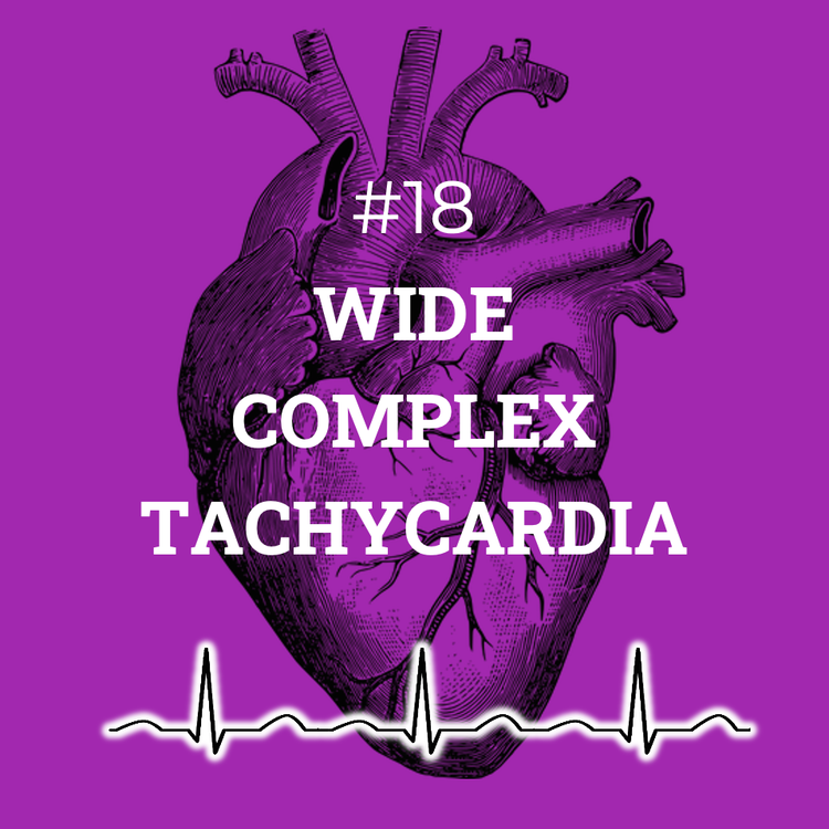 cover art for #18 Wide complex tachycardia