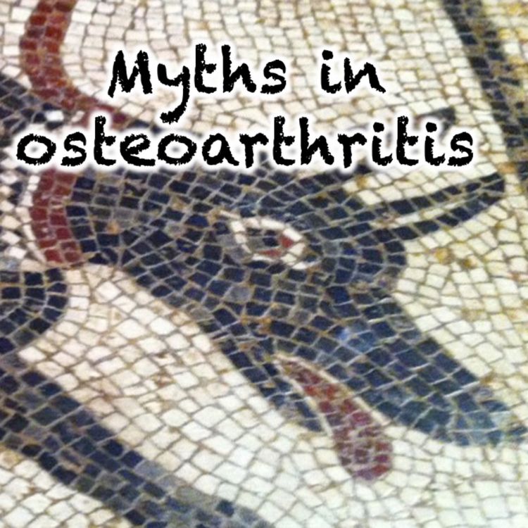 cover art for 153 Myths in osteoarthritis  