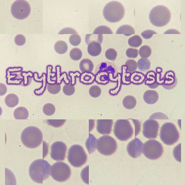 cover art for 152 Erythrocytosis