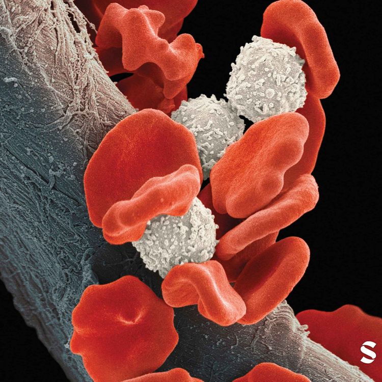 cover art for Shifting Treatment Paradigm in Multiple Myeloma: A Podcast Integrating ASH 2025 Data with Patient and Physician Perspectives