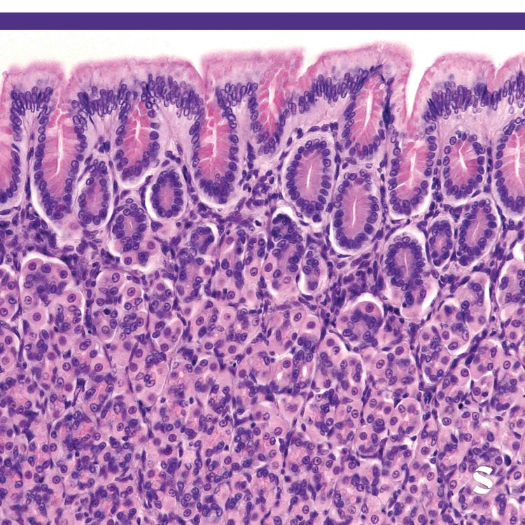 cover art for Facilitated reintroduction of eliminated eosinophilic esophagitis trigger foods with dupilumab