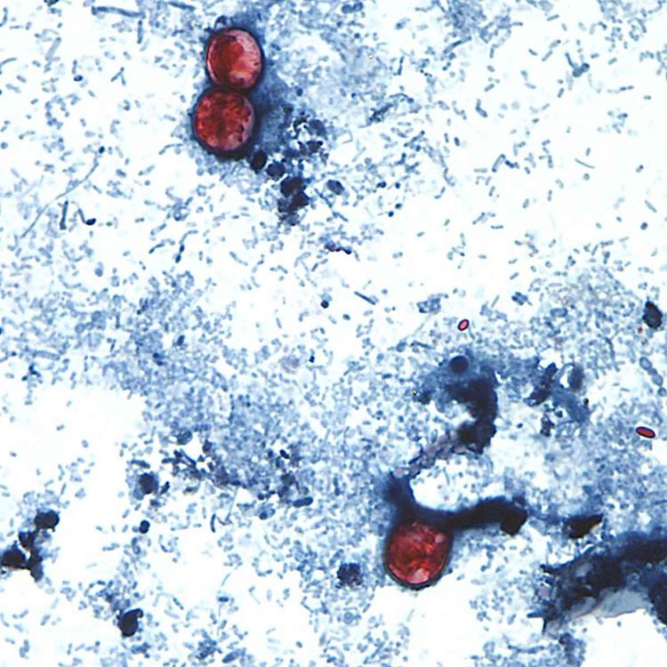 cover art for How Trump made it harder to fight the cyclospora parasite outbreak 